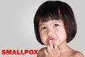 Little Girl With Smallpox