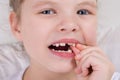 A little girl wobbles a milk tooth, with two fingers Royalty Free Stock Photo