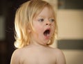Little girl yawns