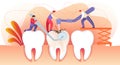 Little People Drilling Unhealthy Tooth with Caries