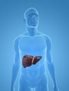 Liver cancer Royalty Free Stock Photo