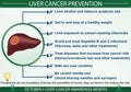 Liver Cancer Prevention Infographic Vector Illustration