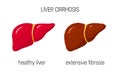 Liver cirrhosis concept