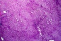 Liver edema, light micrograph Royalty Free Stock Photo