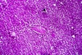 Liver edema, light micrograph Royalty Free Stock Photo