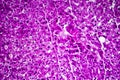 Liver edema, light micrograph Royalty Free Stock Photo