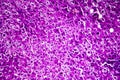 Liver edema, light micrograph Royalty Free Stock Photo