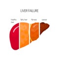 Liver failure vector concept