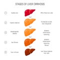 Liver failure vector concept