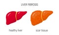 Liver fibrosis concept