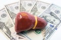 Liver figure lying on money - dollars banknotes. Photo for determining cost of treatment of liver diseases such as hepatitis C, ci