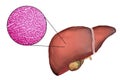 Liver illustration and micrograph Royalty Free Stock Photo