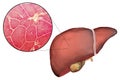 Liver illustration and micrograph Royalty Free Stock Photo
