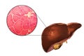 Liver illustration and micrograph Royalty Free Stock Photo