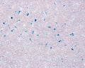 Liver. Kupffer cells labelled with Trypan blue