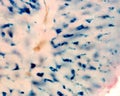 Liver. Kupffer cells loaded with iron. Perlâs reaction Royalty Free Stock Photo
