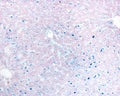 Liver. Kupffer cells labelled with Trypan blue Royalty Free Stock Photo