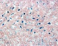 Liver. Kupffer cells labelled with Trypan blue Royalty Free Stock Photo