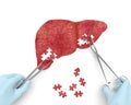 Liver operation puzzle