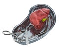 Liver transplant surgery concept. Donor liver in metallic tray w