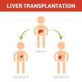 Liver transplantation concept