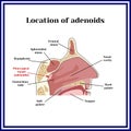 Location of adenoids.The structure of the nasopharynx