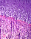 Long bone ossification. Epiphyseal growth plate