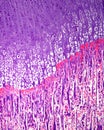 Long bone ossification. Epiphyseal growth plate