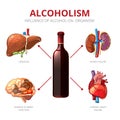 Long-term effects of alcohol. Alcoholism vector infographic