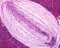 Pacinian corpuscle Royalty Free Stock Photo