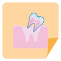 loose tooth from gum. Vector illustration decorative design Royalty Free Stock Photo