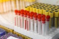 A lot of Blood sample tubes empty in laboratory test, Selective focus