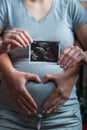 Loving couple in anticipation of baby is holding ultrasound scan.. Royalty Free Stock Photo