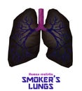 Low poly realistic human lungs and bronchus with cancer inflammation disease. Vector.