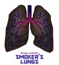 Low poly realistic human lungs and bronchus with cancer inflammation disease. Vector.