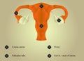 Low poly uterus and ovary structure