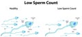 Nízky spermie počítať 