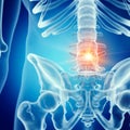 lower back pain Royalty Free Stock Photo