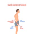 Crooked man with lower crossed syndrome imbalance