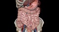 The lower gastrointestinal (GI) tract is the last part of the digestive tract