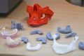 The lower jaw of a man, created on a 3d printer from a photopolymer material. Stereolithography 3D printer, technology of liquid p
