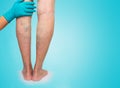 Lower limb vascular examination because suspect of venous insufficiency Royalty Free Stock Photo