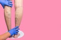 Lower limb vascular examination because suspect of venous insufficiency. Royalty Free Stock Photo