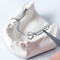 Lower partial denture with attachments