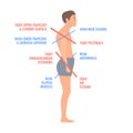 Lower and upper crossed syndrome body diagram