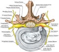 BOARD Lumbar disk herniation, nerve root