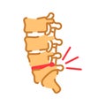 Lumbar osteochondrosis flat color icon. Orthopedics diseases. Pain in spine, bone illness. Sign for web page, mobile app, button,
