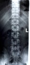 Lumbar spine/Front