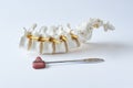 Lumbar spine model and reflex hammer on white background Royalty Free Stock Photo