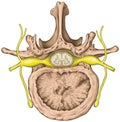 Lumbar spine, Nerve root